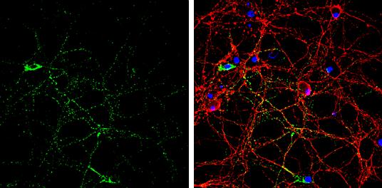 GAD2/GAD65 Antibody