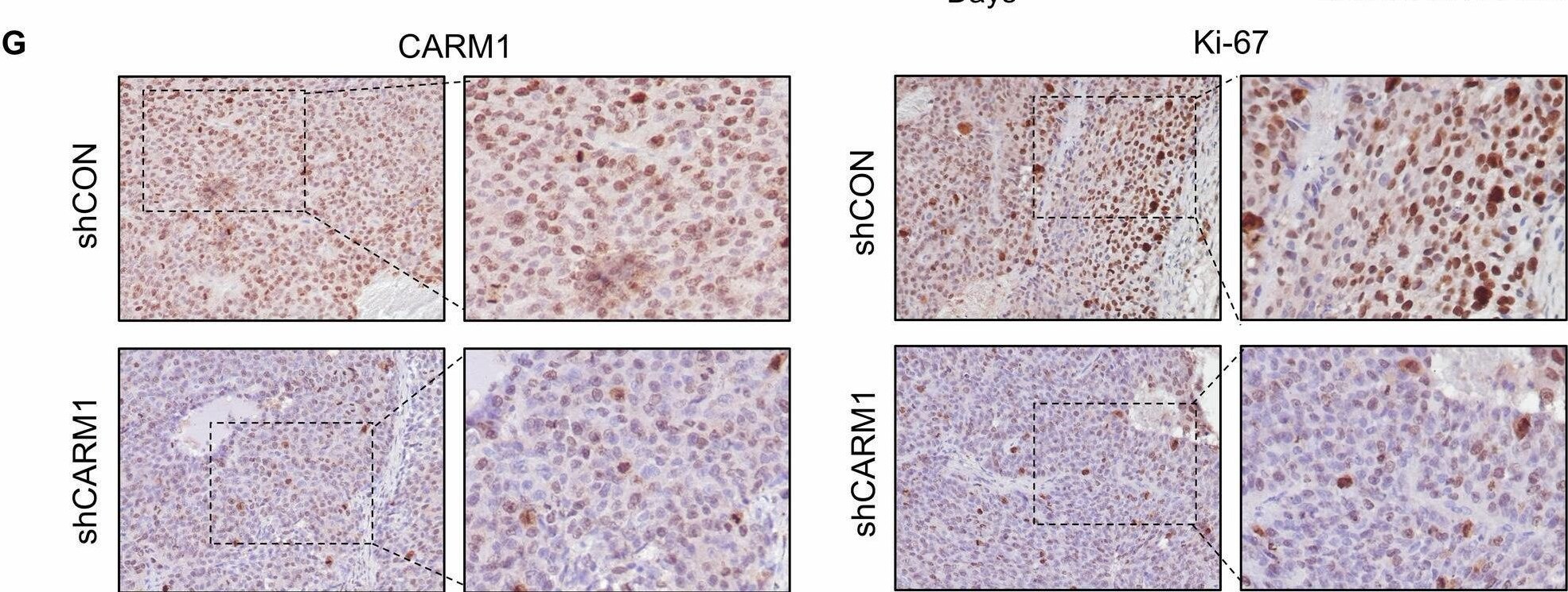 Carm1 Antibody - BSA Free