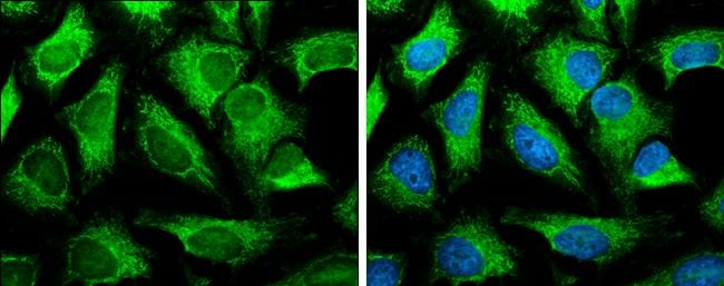 SLC25A13 Antibody - BSA Free