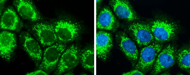 SLC25A22 Antibody