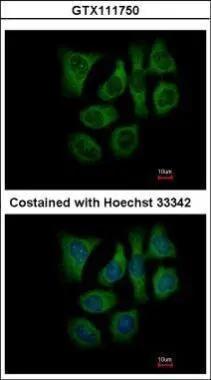 GALK2 Antibody - BSA Free