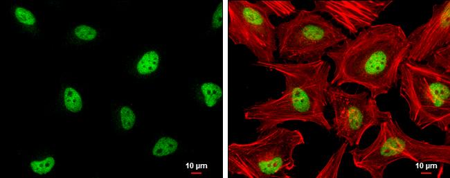 ZHX2 Antibody - BSA Free