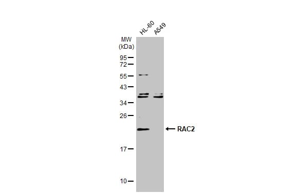 RAC2 Antibody