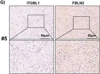 Fibulin 2 Antibody - BSA Free