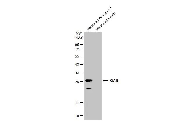 StAR Antibody