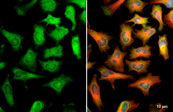 CBS Antibody