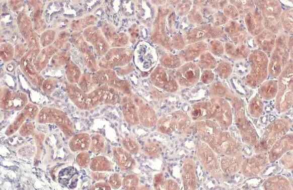 CBS Antibody
