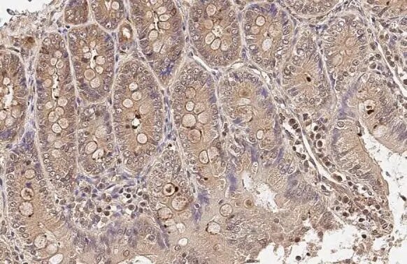 HPRT Antibody