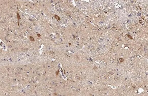 HPRT Antibody