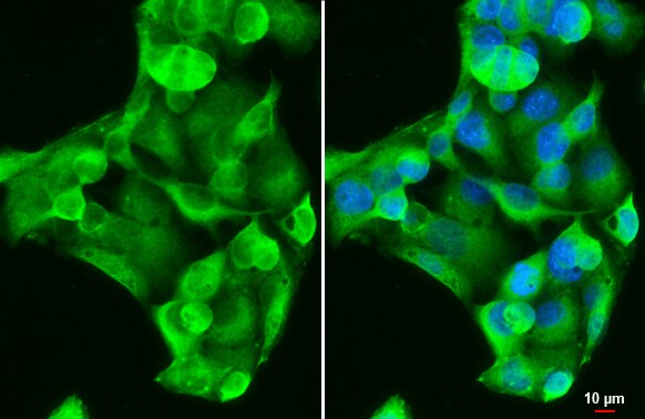 GSTA1 Antibody
