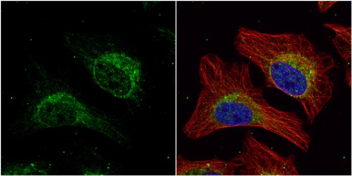 HADHA Antibody - BSA Free