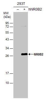 SHP/NR0B2/Nuclear Receptor SHP Antibody