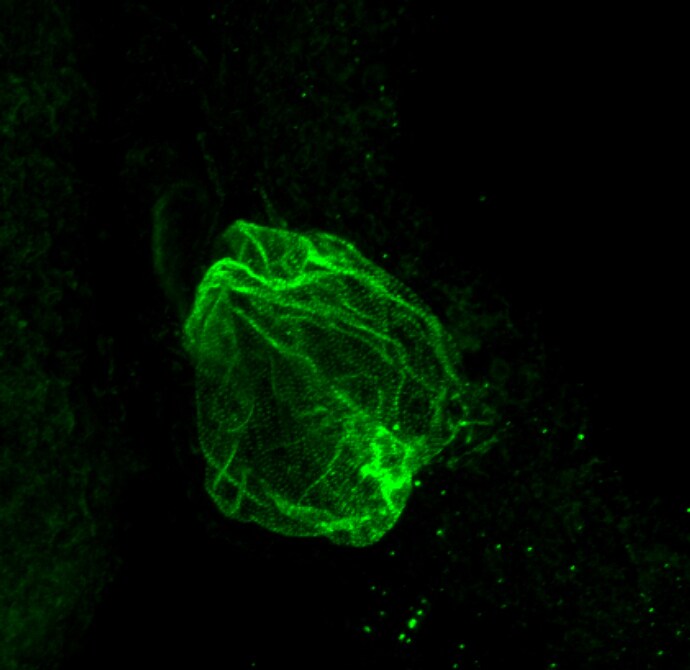 FHL2 Antibody