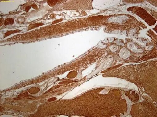 FHL2 Antibody