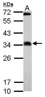 FHL2 Antibody