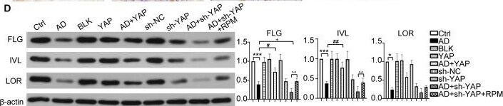 Loricrin Antibody