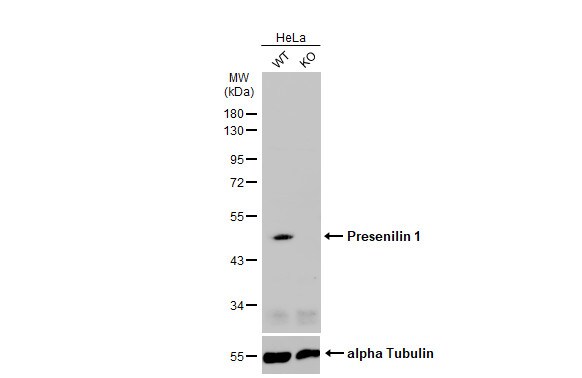 Presenilin-1 Antibody