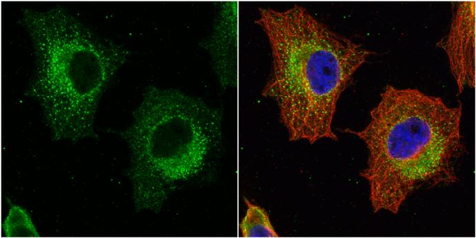 Glutathione S-Transferase pi 1/GSTP1 Antibody - BSA Free