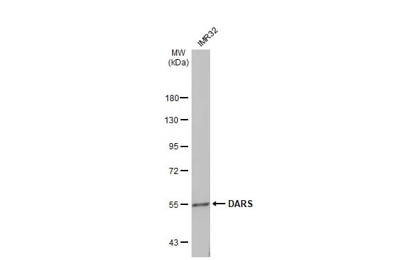 DARS Antibody