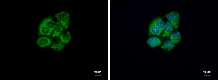 GSTZ1 Antibody