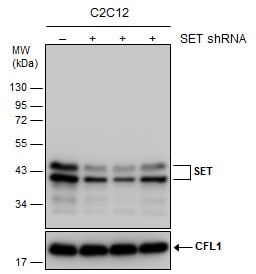 SET Antibody