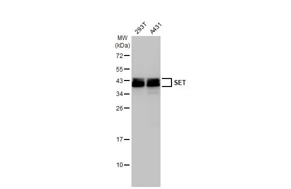 SET Antibody