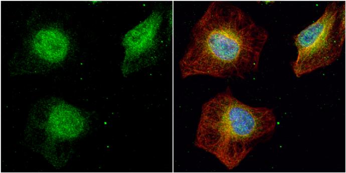 SET Antibody - BSA Free