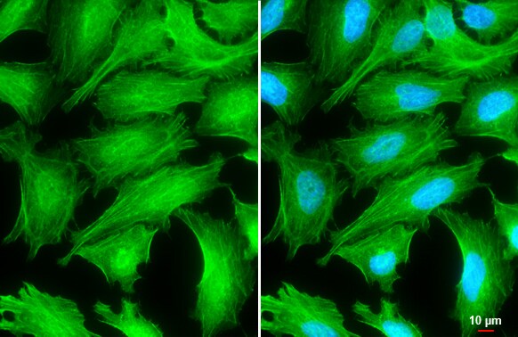 Tropomyosin-1 Antibody