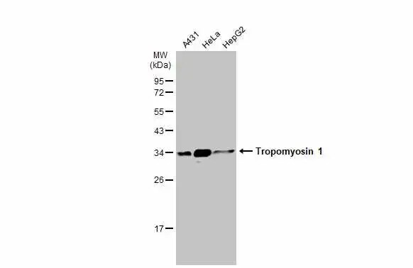 Tropomyosin-1 Antibody