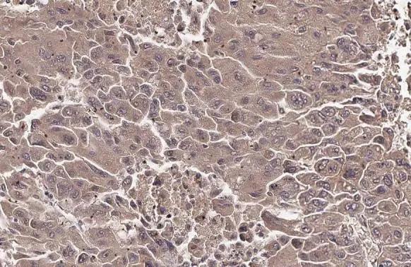 PAPSS2 Antibody - BSA Free