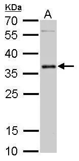 PIM2 Antibody