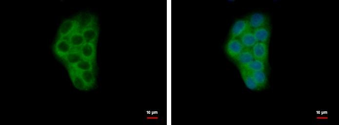 Calcium-binding-protein-P22 Antibody - BSA Free