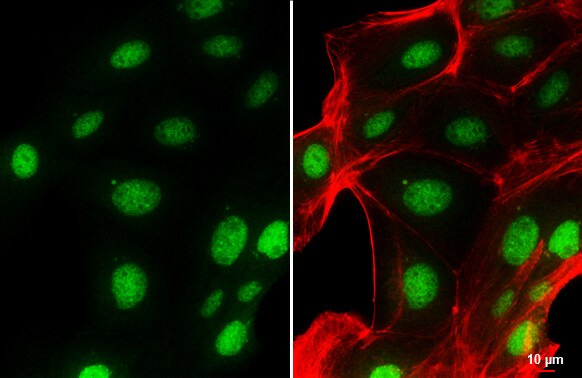 BMI-1 Antibody