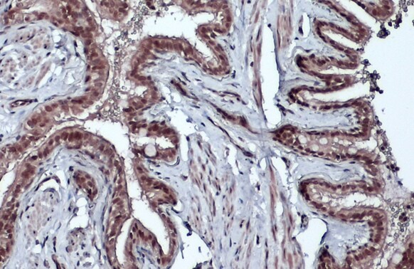 BMI-1 Antibody