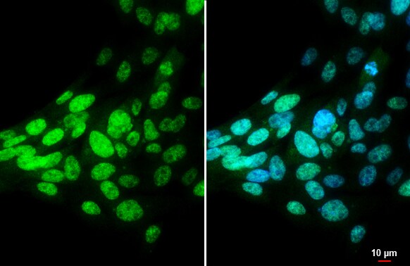 BMI-1 Antibody