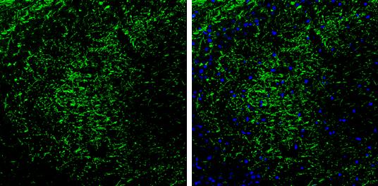 PKA 2 beta Antibody - BSA Free