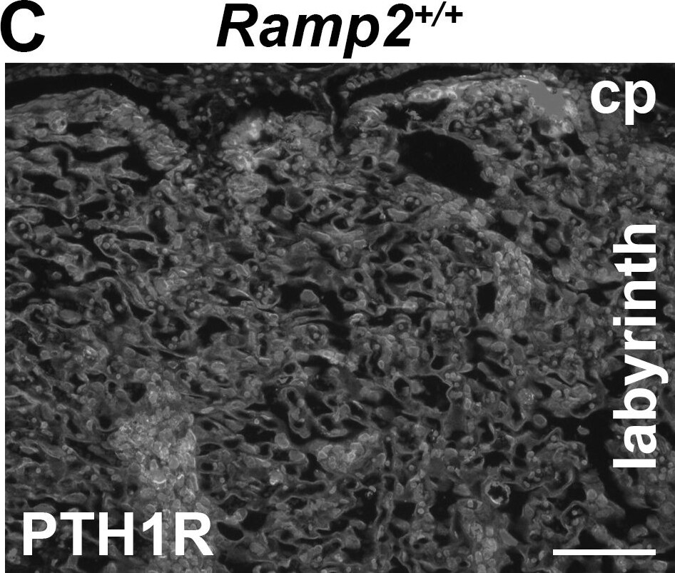 PTH1R/PTHR1 Antibody (3D1.1)