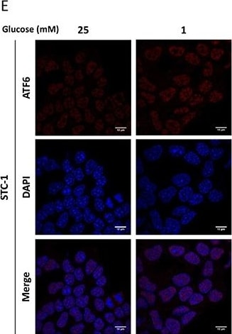 ATF6 Antibody (70B1413.1) - BSA Free
