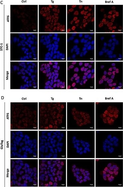 ATF6 Antibody (70B1413.1) - BSA Free
