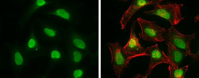 CtIP Antibody (19E8) - Azide and BSA Free