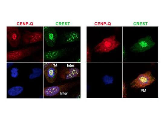 CENPQ Antibody