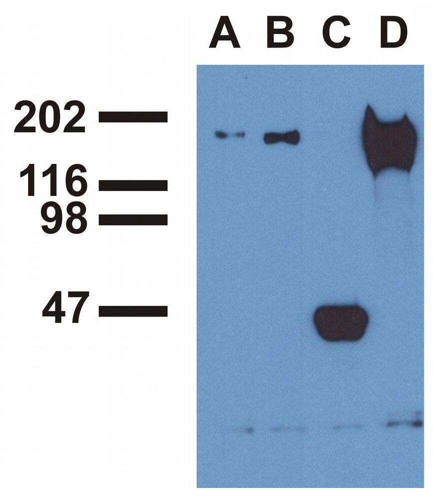 EGFR [p Tyr1173] Antibody (EM-13) - BSA Free Flow Cytometry: EGFR [p Tyr1173] Antibody (EM-13) - BSA Free [NBP1-44893]