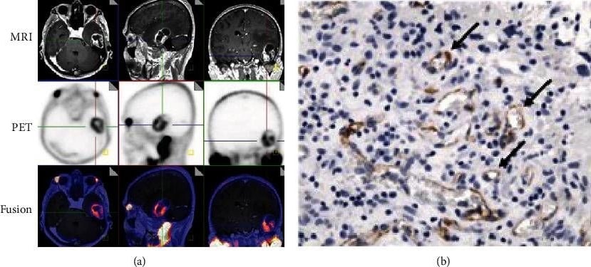 PSMA/FOLH1/NAALADase I Antibody (GCP-04) - BSA Free