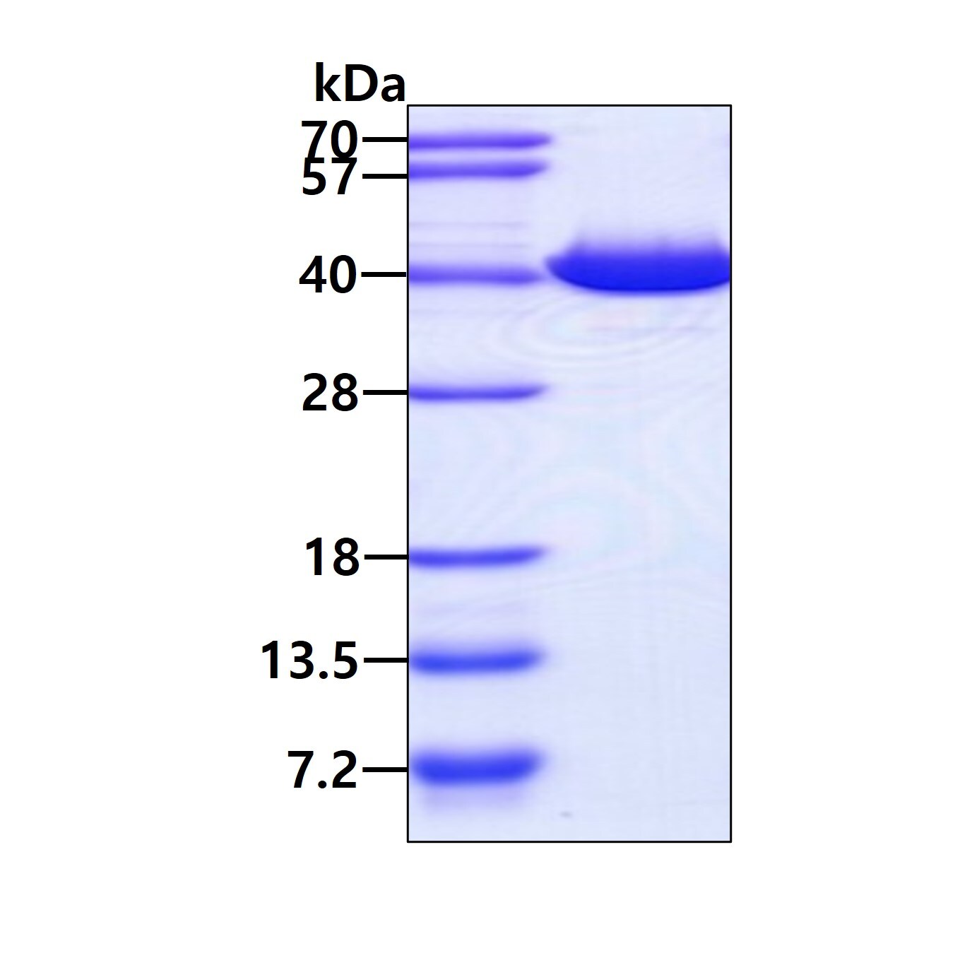 Recombinant Human GALE His Protein