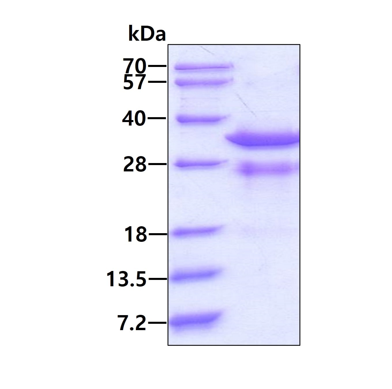 Recombinant Human Rad1 His Protein SDS-Page: Recombinant Human Rad1 Protein [NBP1-45298]