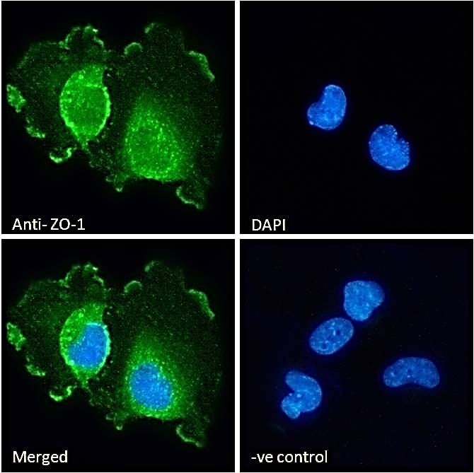 Tight Junction Protein 1 Antibody