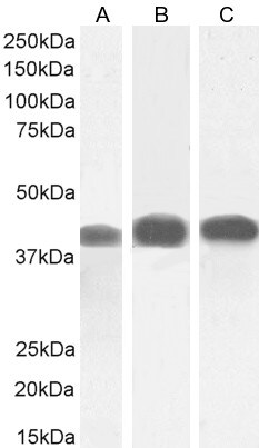 ACAT1 Antibody