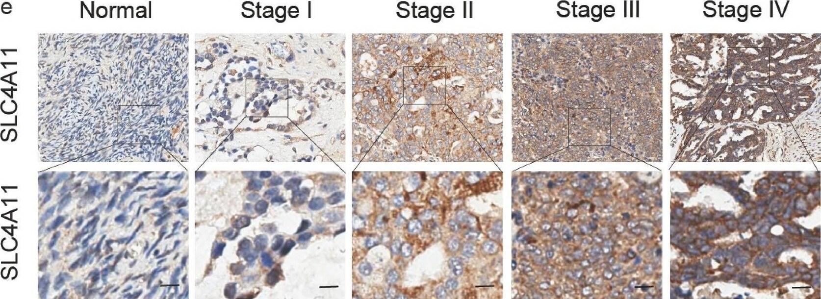 SLC4A11 Antibody