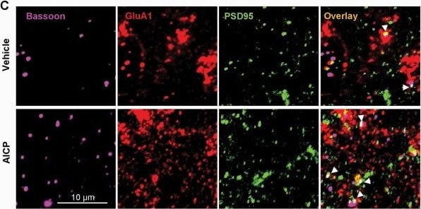 Bassoon Antibody