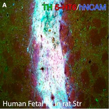 5-HT6 Antibody